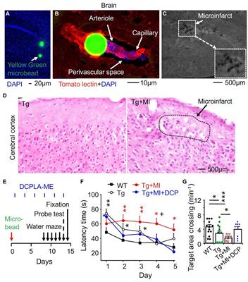 PKCε activator protects hippocampal microvascular disruption and memory defect in 3×Tg-Alzheimer’s disease mice with cerebral microinfarcts